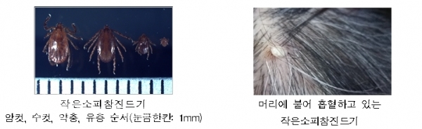 SFTS를 매개하는 작은소피참진드기