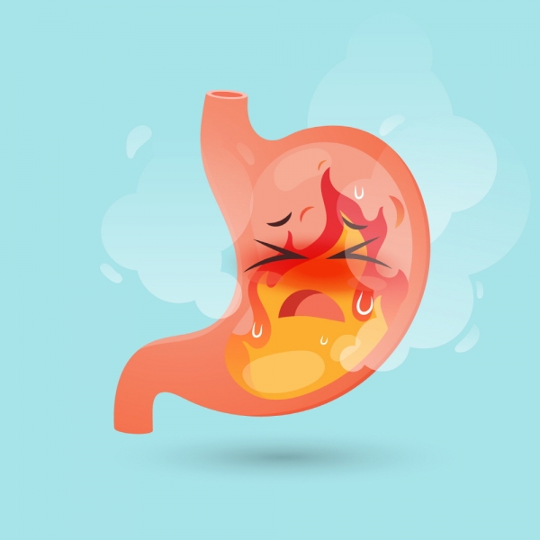 역류성 식도염 이미지