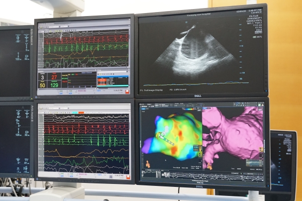심장부정맥센터, 첨단 심방세동 치료 장비 ‘리드미아’ 국내 최초 정식 도입