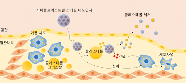 사이클로덱스트린-스타틴 나노입자의 시너지 치료 효과를 보여주는 모식도