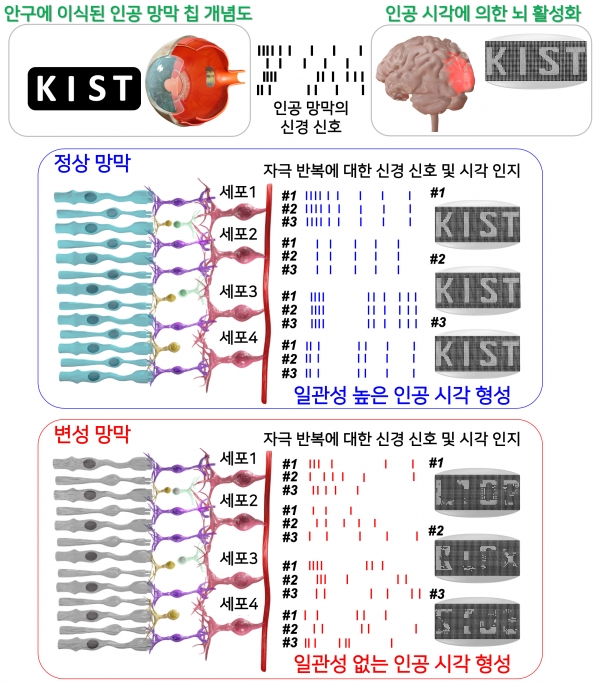 인공 망막 장치 이식 및 인공 시각 신경 신호에 의한 뇌 시각 피질의 활성화 개념도(위)와 정상 망막(중간)과 변성 망막(아래)의 시각 정보 차이점
