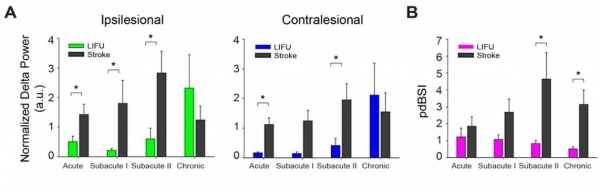 초음파 자극 그룹과 비 자극 그룹에서 델타파의 변화