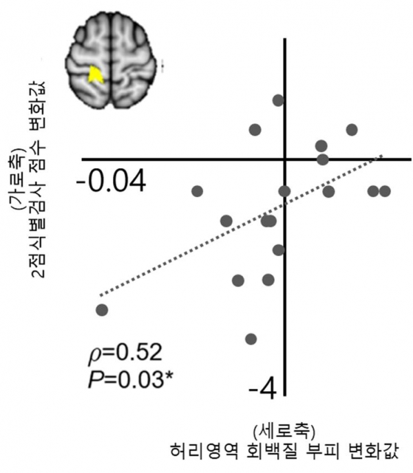 허리부위 촉각예민도와 회백질 부피 변화 값 사이의 상관성 그래프