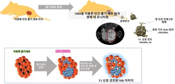 MR 영상 기반의 인간 줄기세포의 모니터링 시스템의 개략도