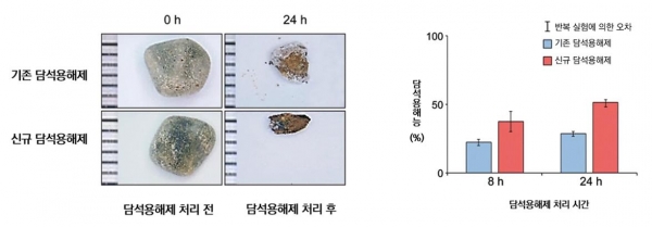 담석증 환자에게서 나온 담석으로 실험한 결과