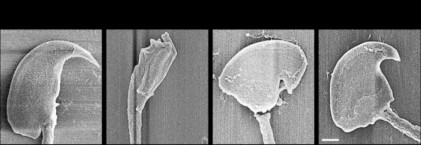 정상 생쥐(마우스) 정자와 테쉴(Teshl) 결핍 생쥐 정자 비교