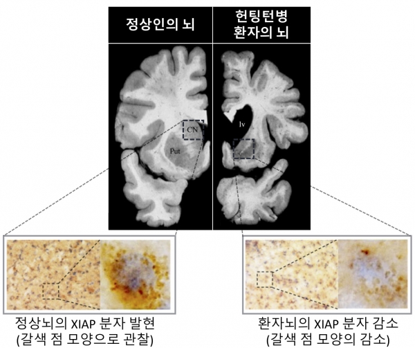 정상인의 뇌와 헌팅턴병 환자의 뇌에서 XIAP 분자의 발현 정도 차이