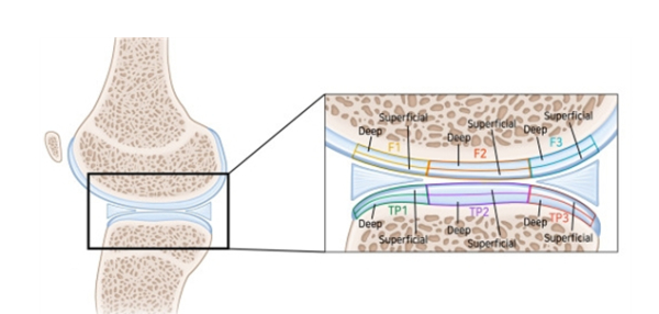 그림 : 6부분(F1, F2, F3, TP1, TP2, TP3의 표면층, 심층)으로 나눈 관절 이미지