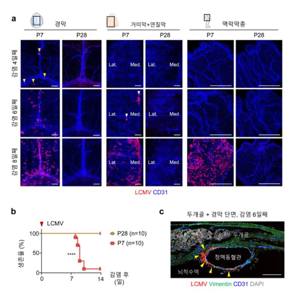생쥐 연령별 뇌수막염 바이러스 감염 모델 면역반응의 차이