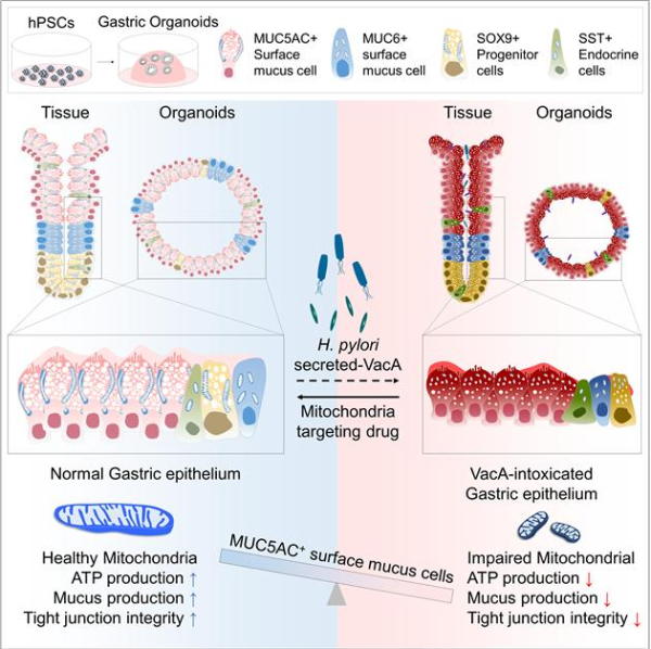 핼리코박터 파일로리 감염과 VacA 독소 노출 시 인산화효소(키네이스) 저해제의 효능 모식도
