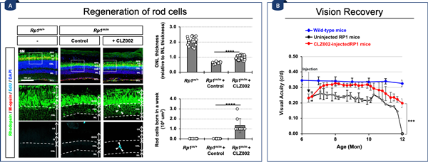 유전자 치료제 투여를 통한 망막색소변성증 모델 생쥐 망막 재생과 시력 회복