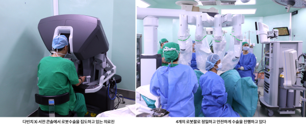 로봇수술 모습(단국대병원)