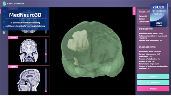 ‘MedNeuro3D’ AI 기반3D 뇌 구조 모델링 후 최적 수술 경로 시뮬레이션 결과